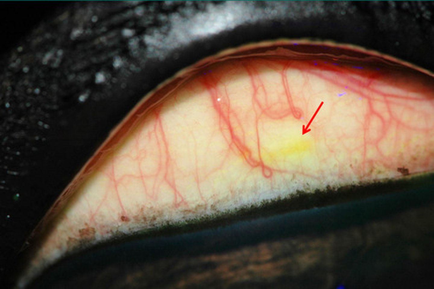 <p>What is happening here? How do you treat?</p>