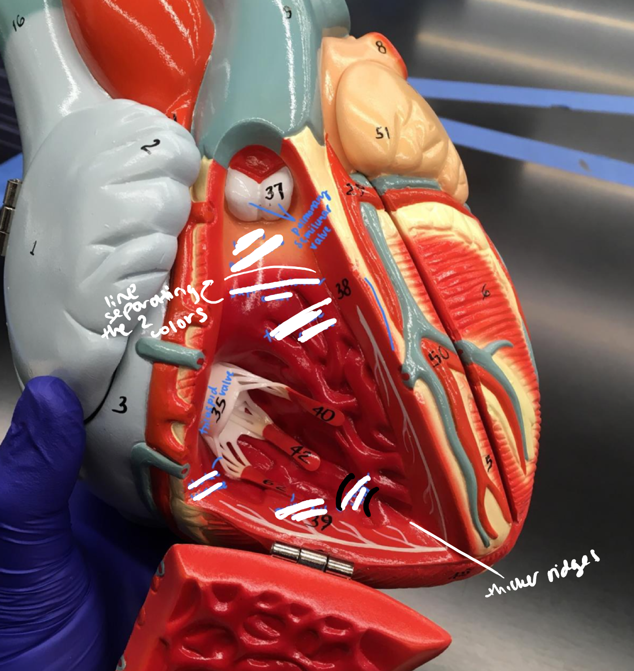 <p>The band connecting the trabeculae carnae under the pulmonary semilunar valve</p>