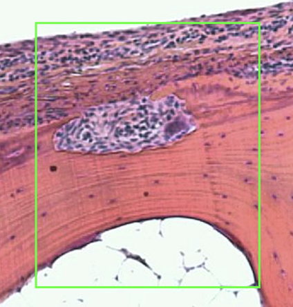 <p>what does this histological image show </p>