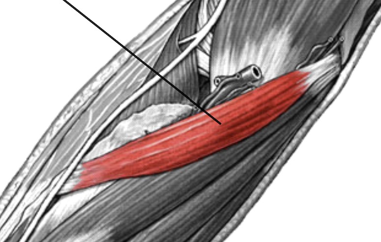 <p>Which muscle of the forearm is:</p><ul><li><p>Located on anterior elbow</p></li><li><p>Action: pronates forearm</p></li><li><p>Nerve: median</p></li></ul><p></p>