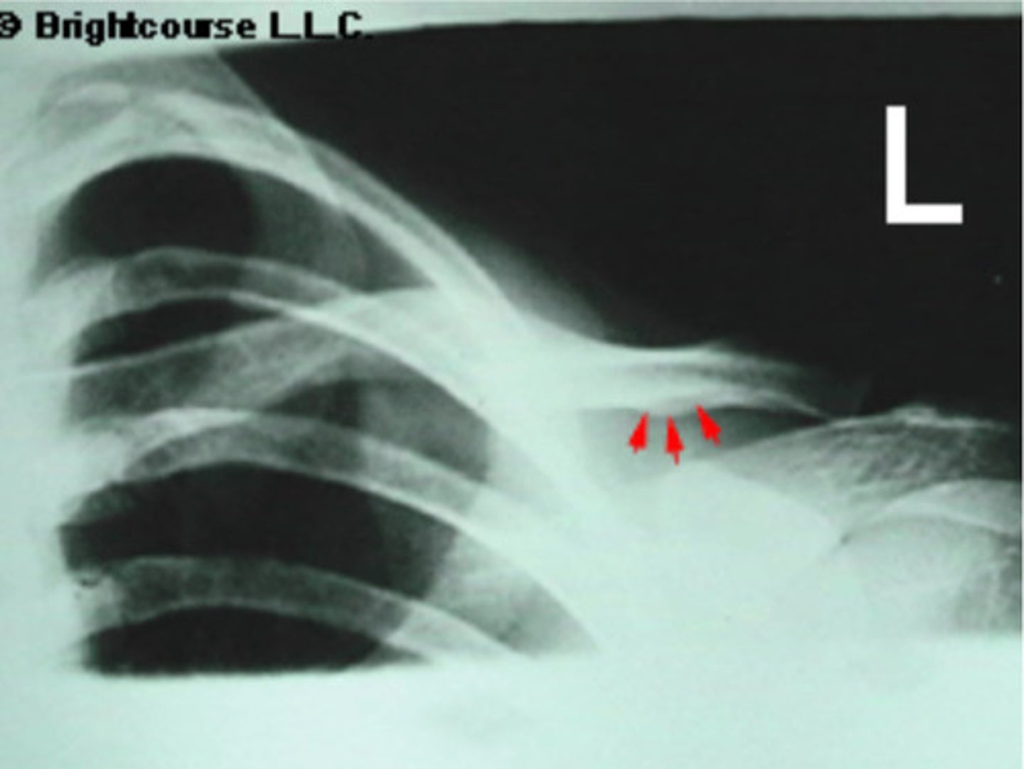 <p>What is being pointed out by the arrows in the image?</p>