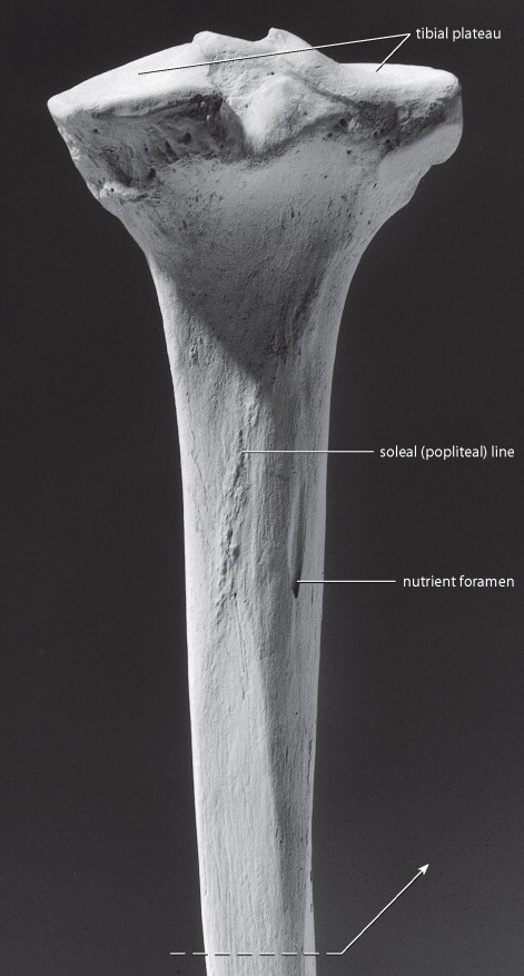<p>oblique line on the posterior, goes from inf/medial to sup/lateral. it is a raised line that points UP to the side it is from</p>