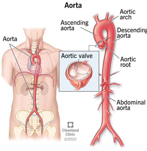 <p>Largest artery in the heart, the main artery that carries blood away from your heart to the rest of your body</p><p>Aortas → arteries → arterioles<strong> (ARTERIAL SYSTEM)</strong></p>