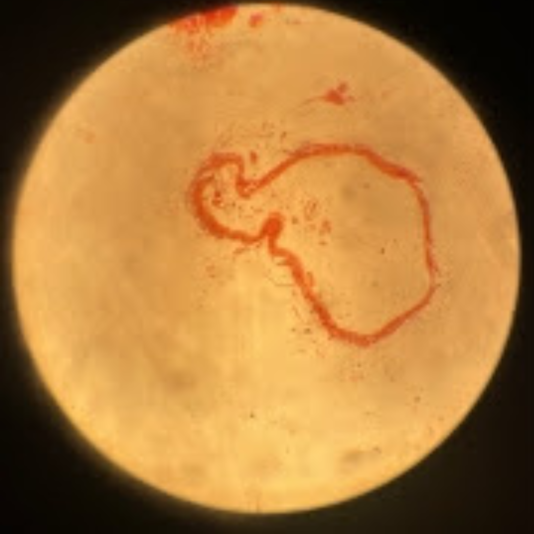 term image