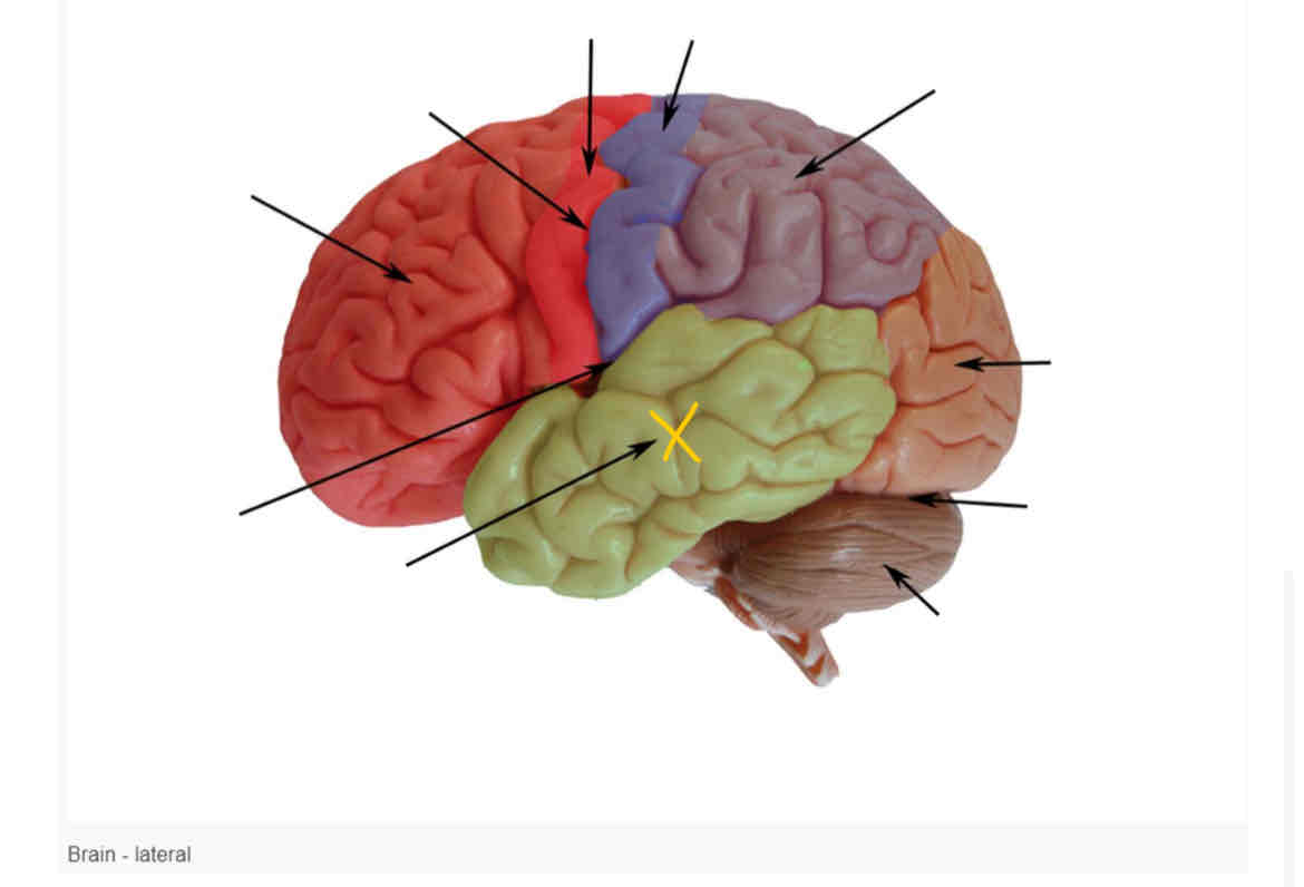 term image