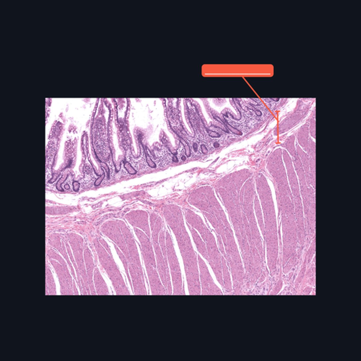 <p>Identify the pointed histologic layer of the digestive tract</p>