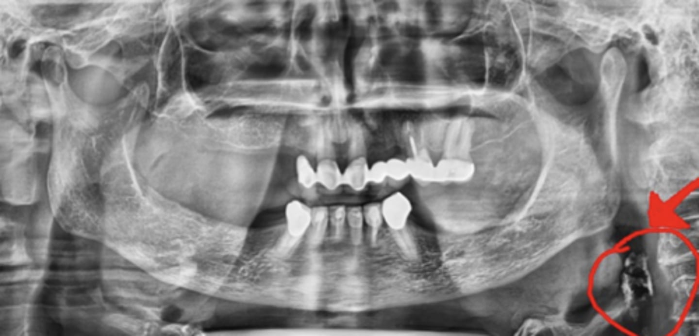 <p>Near C3-C4 vertebrae</p><p>*will not be tested to ID on final</p>