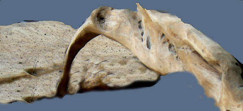 <p>settling or fixing rigidly in a practice, custom, or attitude</p>