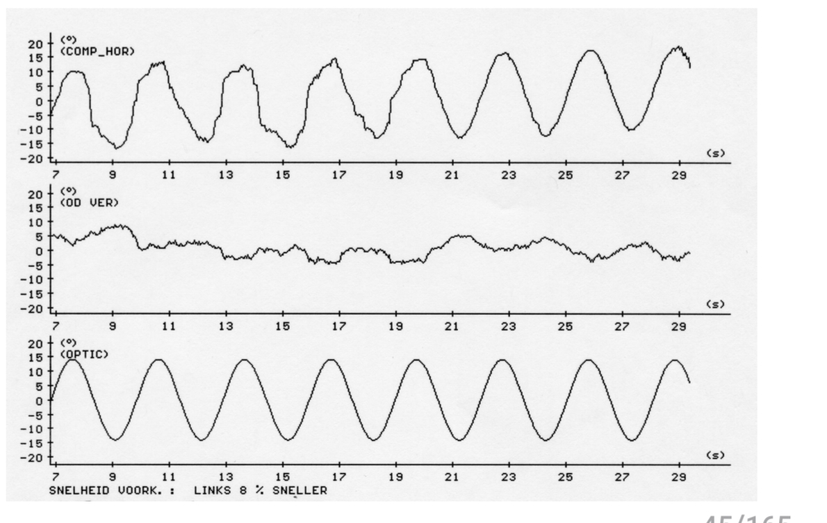 <p>blikwijzigende oogbewegingen</p><p>Normaal: intacte (goeie morfologie) beweging <br>naar links en rechts</p><p>Gestoorde smooth pursuit</p><ul><li><p>Haperend, gedisconjugeerd, asymmetrisch</p></li><li><p>Centrale oorzaak (hersenstam, cerebellair, <br>cerebraal corticaal)</p></li><li><p></p></li><li><p>Spontane nystagmus met gestoorde oogvolgbeweging in de richting vd snelle fase → kunnen deze testen verstoren!</p></li><li><p>Gaze evoked nystagmus</p></li></ul><p>!!Concentratiestoornissen, Leeftijd, Medicatie!!!</p>