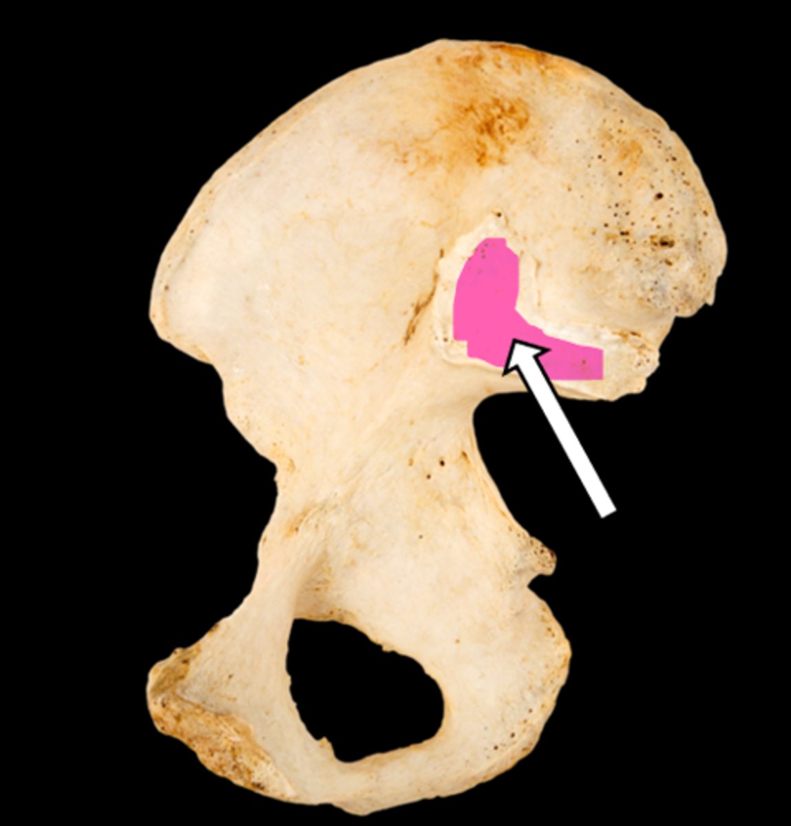<p>name the part</p>