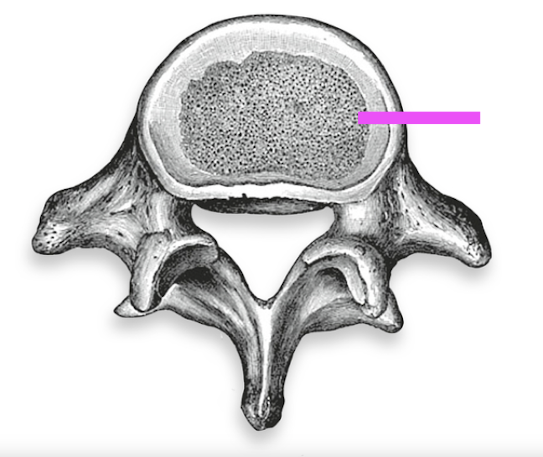 <p>What part of the vertebrae is this?</p>
