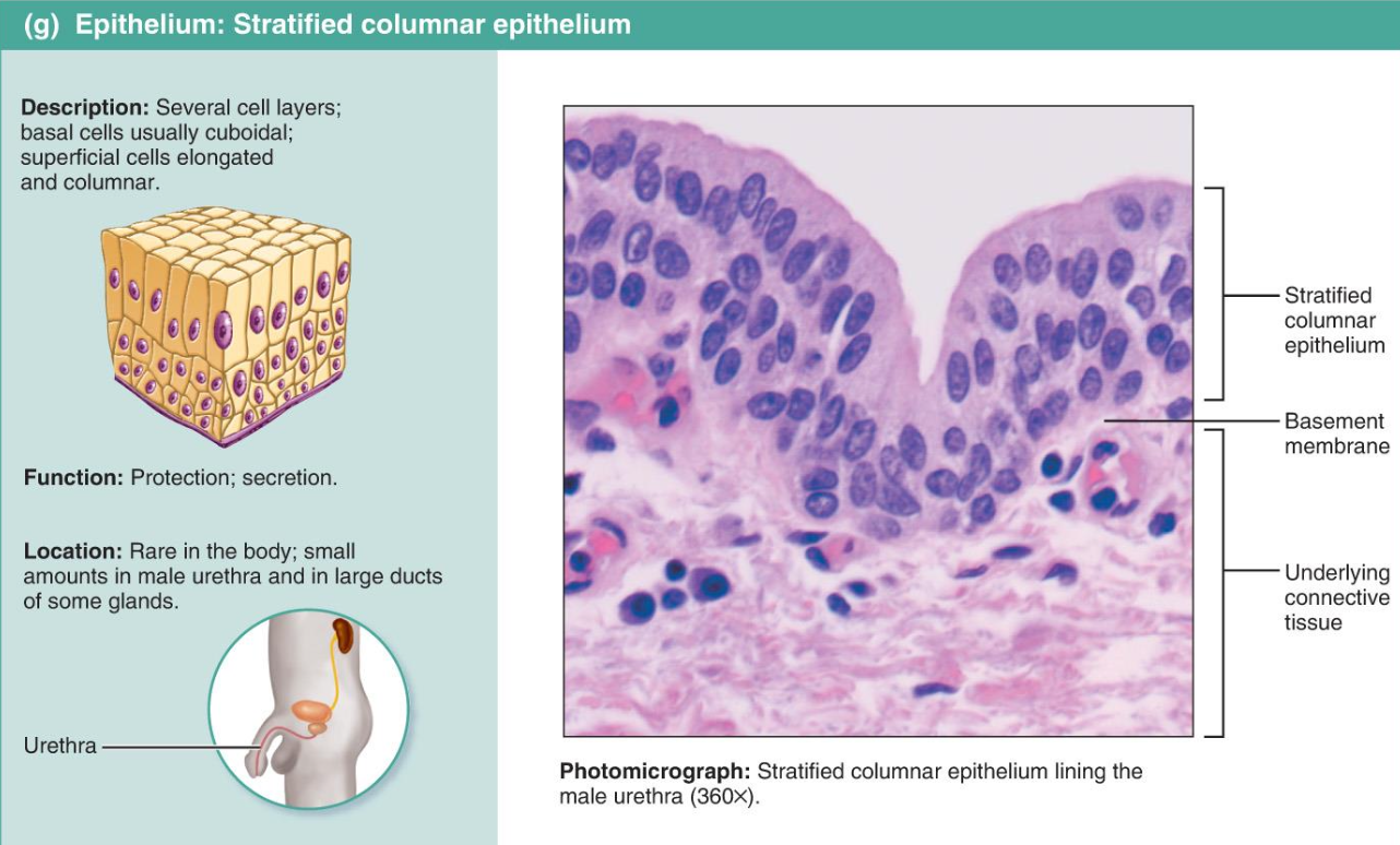 <p>Stratifed columnar</p>