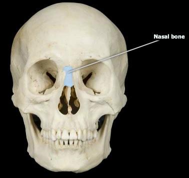 <p>nasal bone</p>