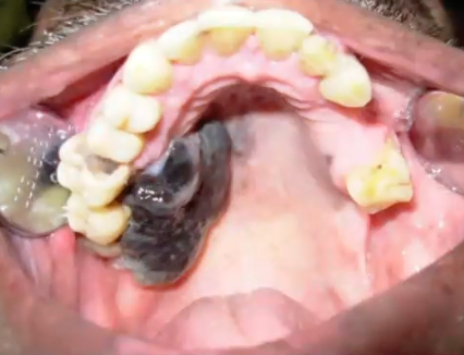 <p>what is the most likely diagnosis </p>