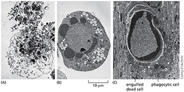 <p>(Q021) Which of the following cells died by apoptosis?</p>
