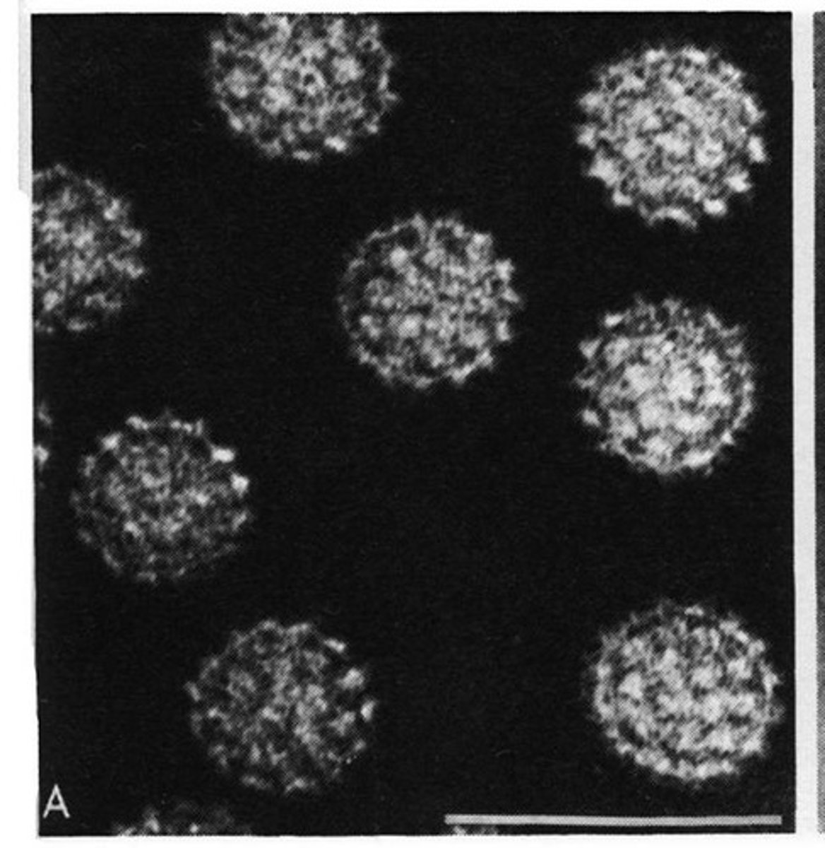 <p>Naked dsDNA virus that causes cervical cancer and warts. Sexually transmitted infections common prior to creation of HPV vaccine</p>