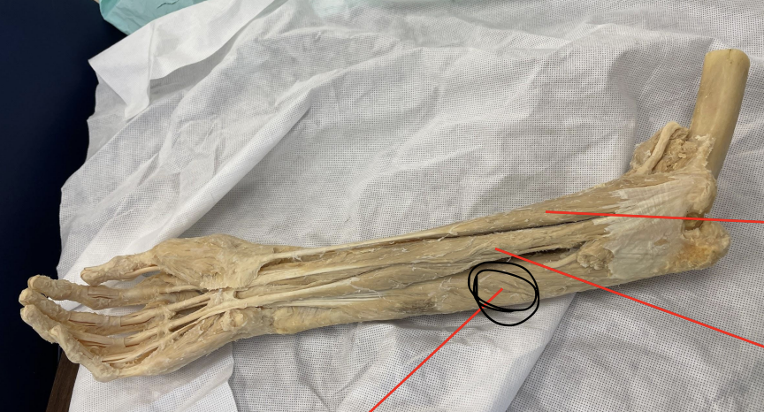 <p>identify + state origin, insertion, action, innervation of marked structure</p>