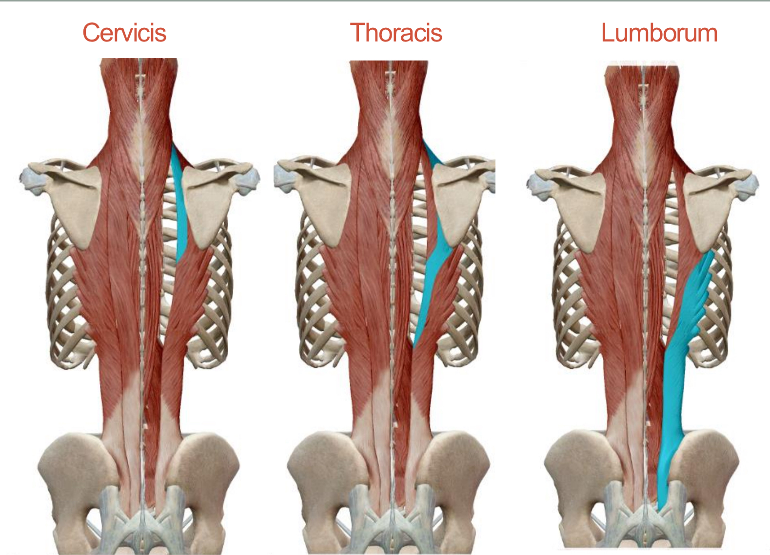 <p>Erector Spinae: Iliocostalis&nbsp;</p><p>Origin:</p><p><strong>Cervicis</strong>: Superior 6 ribs&nbsp;</p><p><strong>Thoracis</strong>: Inferior 6 ribs</p><p><strong>Lumborum</strong>: Iliac crest</p><p>Insertion:</p><p><strong>Cervicis</strong>: TP of C4-C6</p><p><strong>Thoracis</strong>: Superior 6 ribs</p><p><strong>Lumborum</strong>: Inferior 6 ribs</p><p>Action:<strong> Together</strong>: Extend and maintain erect posture of spine<strong> Singly</strong>: Laterally flex vertebral column of respective region&nbsp;</p><p>Innervation: Spinal Nerves</p>