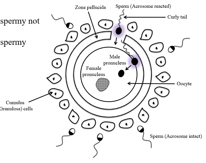 <p>The sperm that receives capacitation. Altered PM allows for exposure to membrane bound enzymes to make channel through zona pellucida</p>