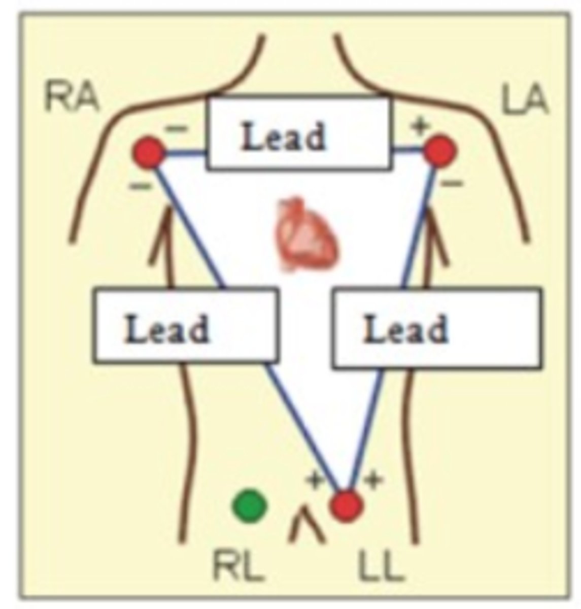 <p>Match the lead to the description.</p><p>1) Lead One</p><p>2) Lead Two</p><p>3) Lead Three</p><p>a. From right arm to left leg</p><p>b. From left arm to left leg</p><p>c. From right arm to left arm</p>