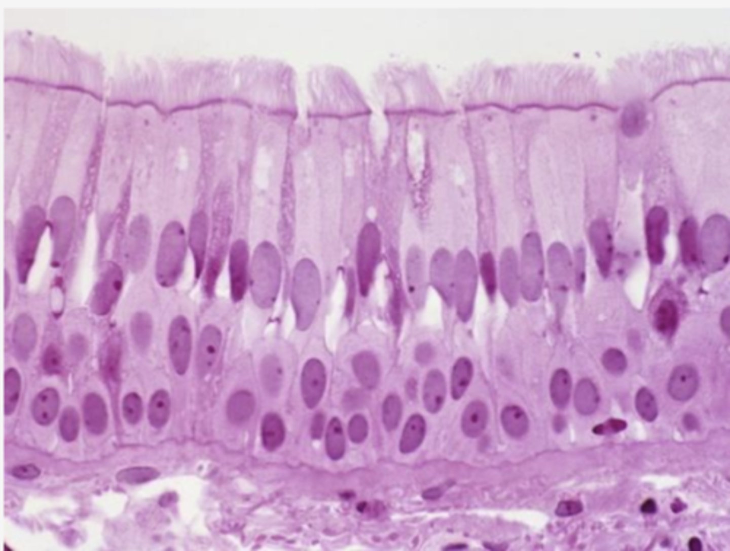<p>Identify the type of epithelia</p>