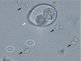 <p>What does the black arrow show?</p>