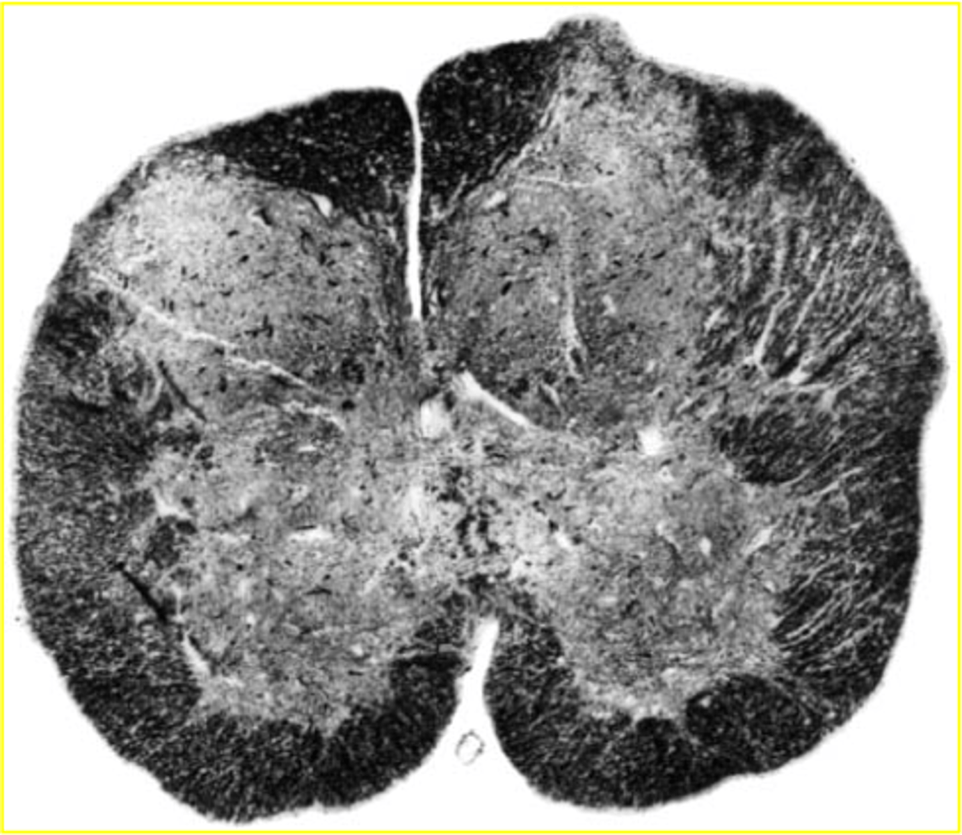 <p>small in diameter, but relatively large amounts of grey matter</p>