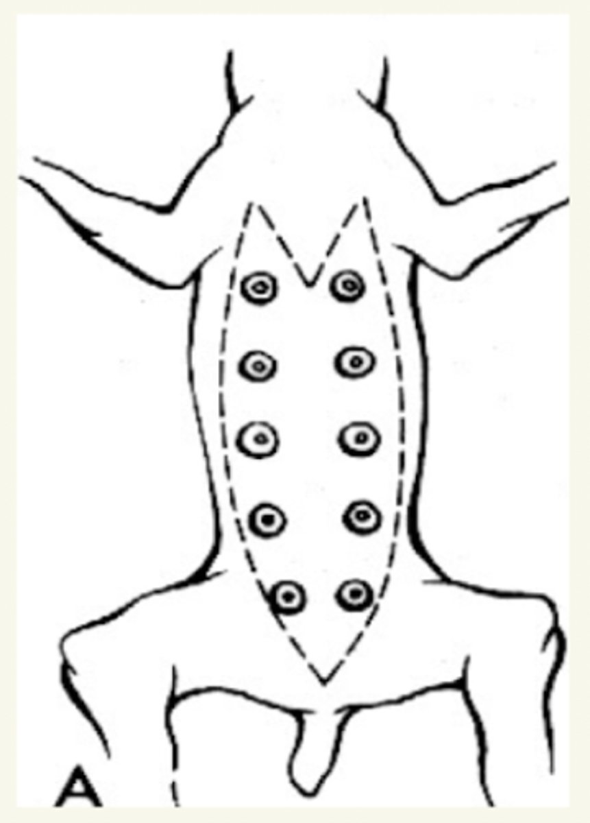 <p>mastectomía bilateral O 2 mastectomías unilaterales en 2-4 semanas (mejor)</p>