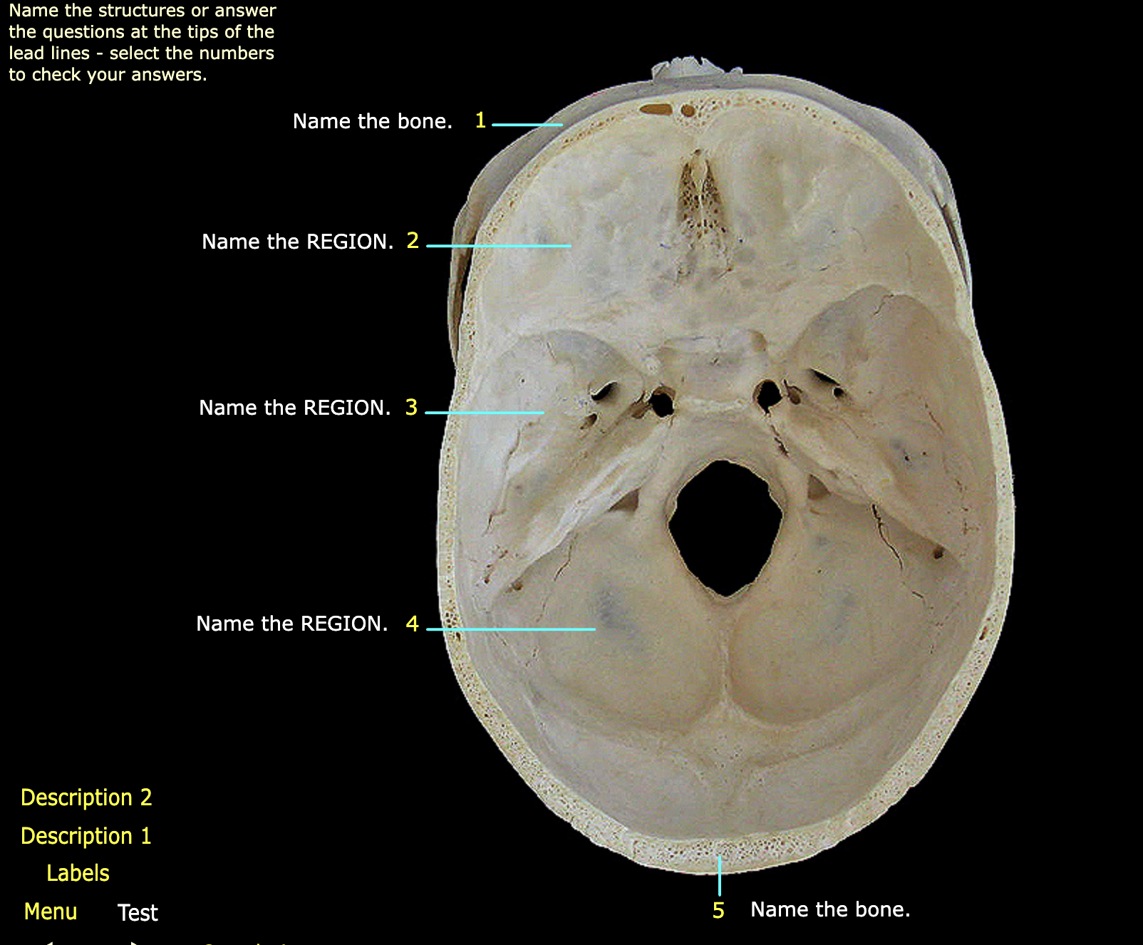 What structure is labeled 5?