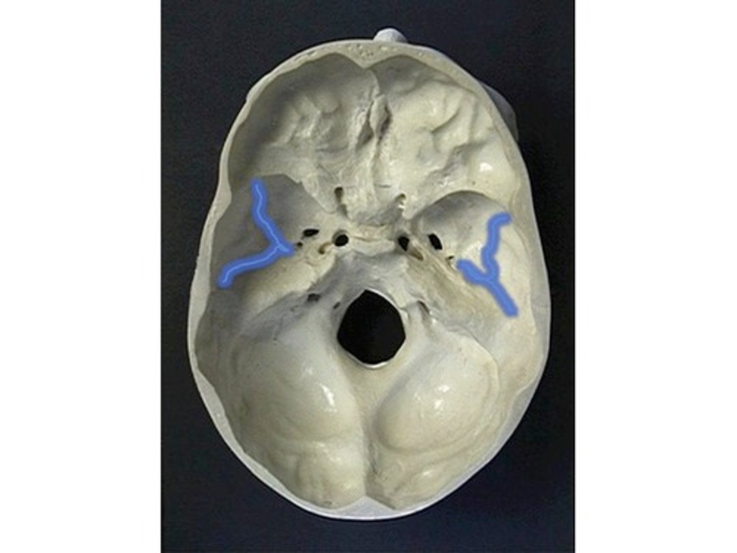 <p>Groove for the middle meningeal artery in the skull.</p>