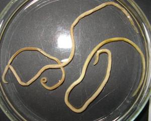 <ul><li><p>Kingdom: Animalia, Phylum: Nematoda</p></li><li><p>Long, not segmented, most numerous and varied of domestic worm parasites. Can cause significant disease in domestic animals</p></li><li><p>Eggs and larvae can be seen in fecal flotation</p></li></ul><p></p>