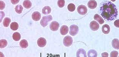 <p>What bacteria is this?</p>