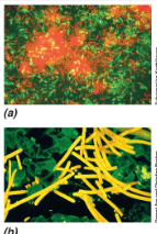 <p><span style="font-family: Georgia, serif;">Uses a computerized microscope with a laser to generate a 3D image, laser focuses on single layers of the specimen and are then compiled to make a 3D image.</span></p>