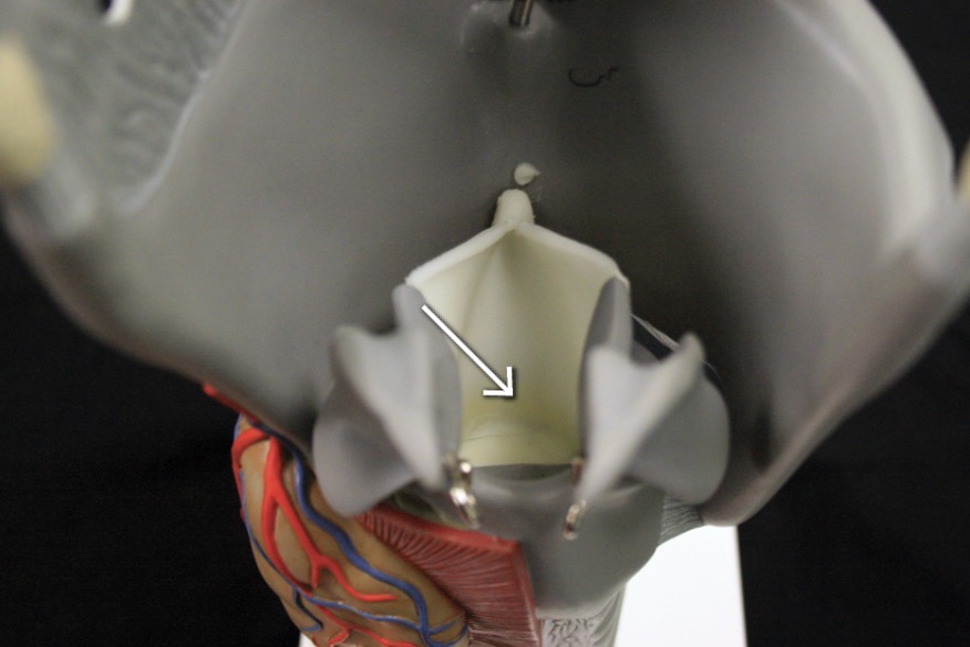 <p>The <strong><em><em></em></strong></em>__ is located at the entrance of the trachea.</p>