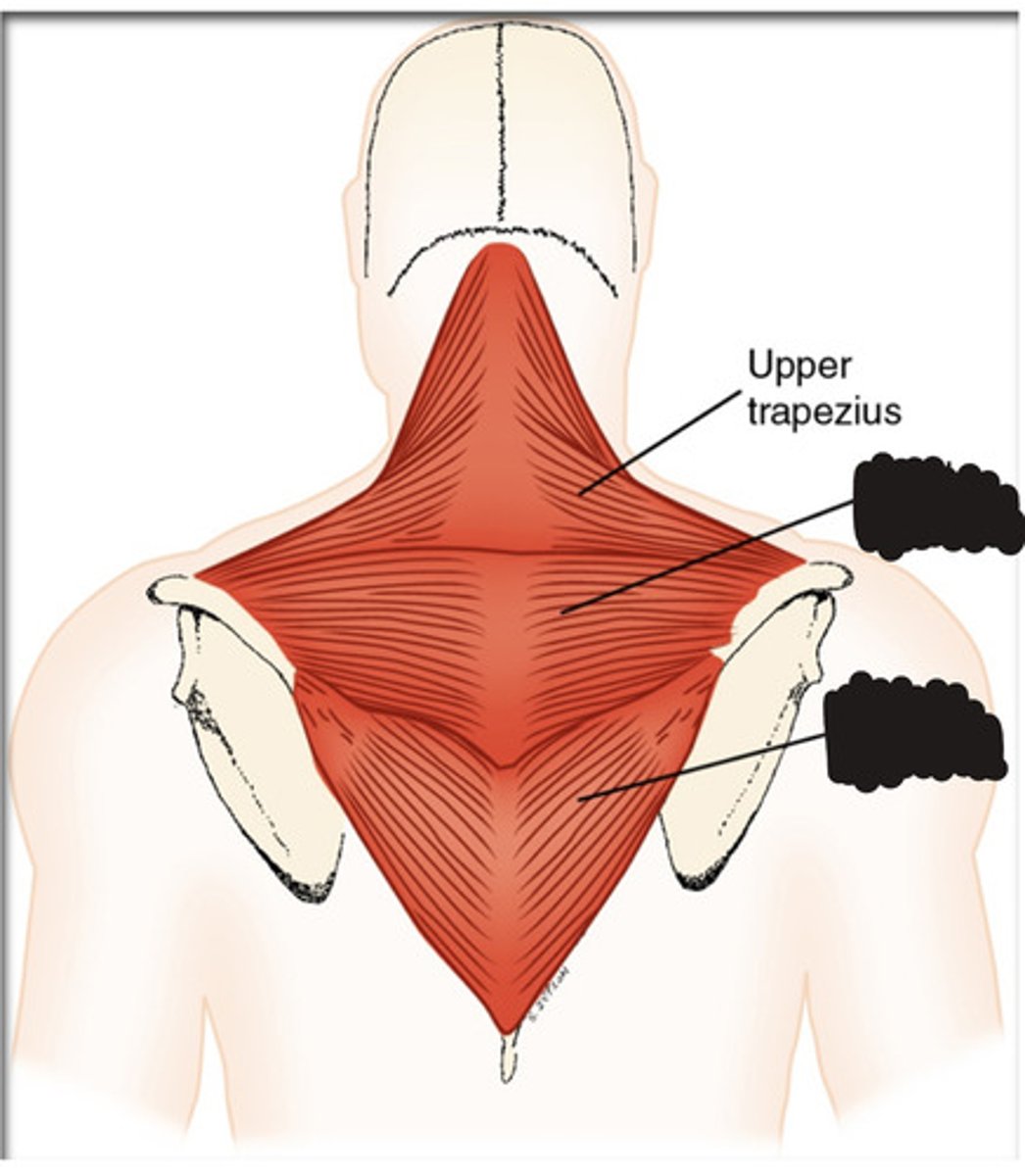 <p>What muscle is this?</p>
