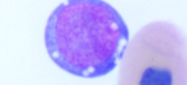 <p>What is this WBC?</p>