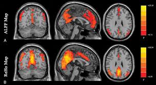<p>shows structure and activity of brain by detecting changes associated with blood flow</p>