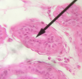 <p>what type of tissue is this </p>