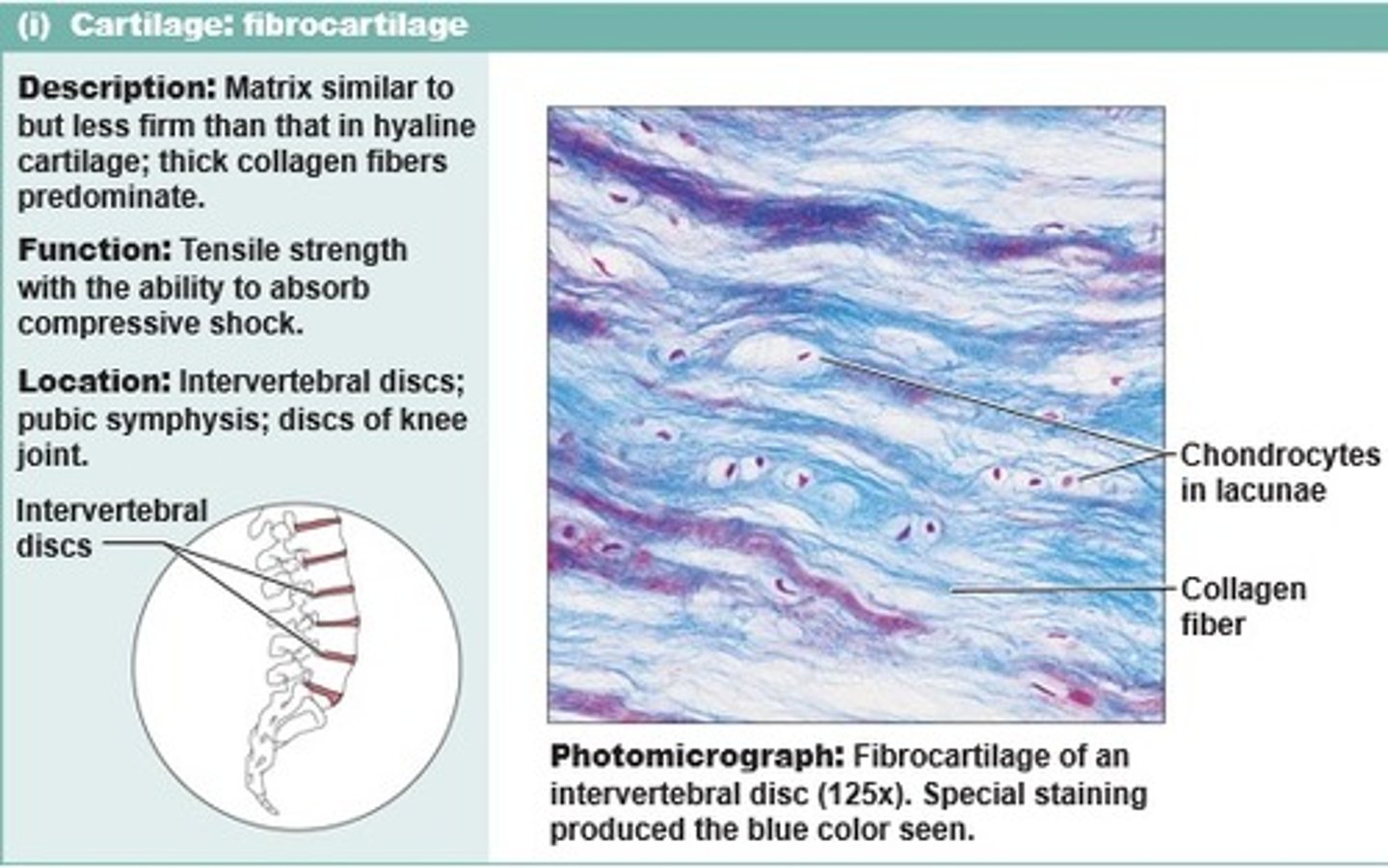 <p>Matrix similar to but less firm than matrix in hyaline cartilage, thick collagen fibers predominate.</p>