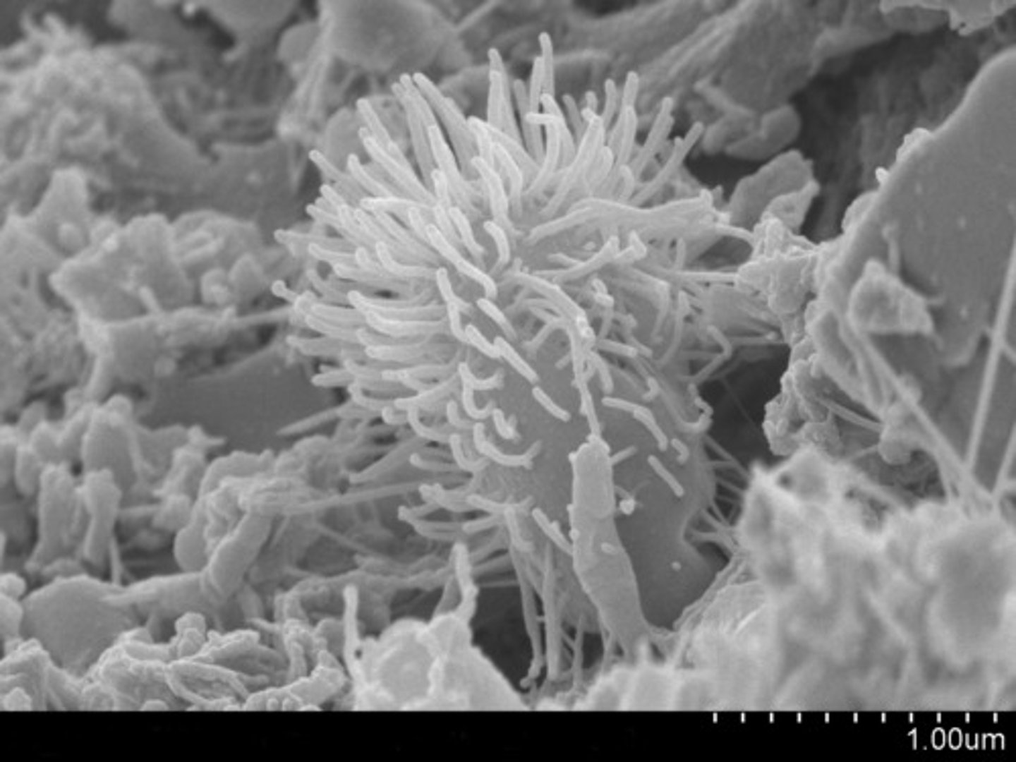 <p>A microscope that uses an electron beam to scan the surface of a sample, coated with metal atoms, to study details of its topography; only dead specimens; up to 1,500,000x magnification; 3D image; on computer screen</p>