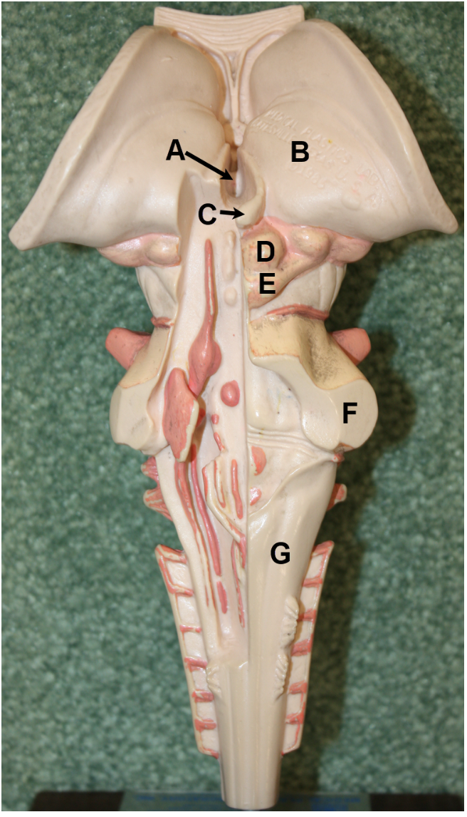 <p><span><span>In the image above (brainstem/diencephalon region), identify structures A-G.</span></span></p>