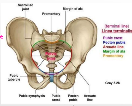 <p><strong>Pelvic Inlet</strong></p><p>-Opening between the __________ and ______ cavities </p><p>-Margins → sacral promotory midline posteriorly, sacral ala posterior/laterally, linea terminalis</p>