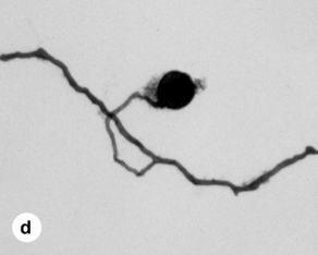 <p><span><strong><em><span>Glomeromycota</span></em></strong></span></p>