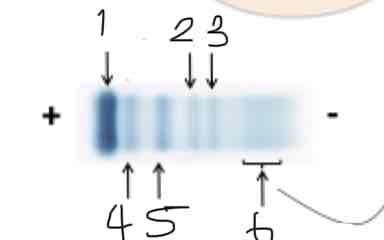 <p>label 1 -6 of this serum electrophoretic pattern </p>