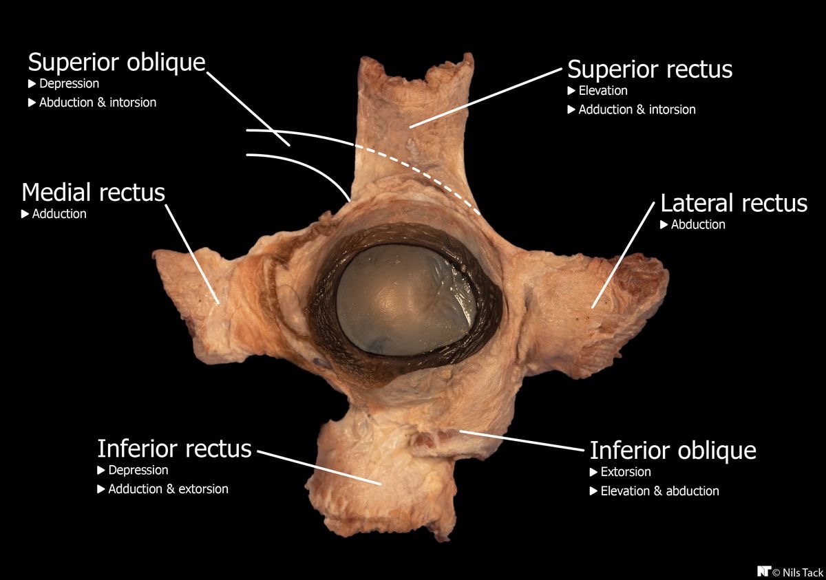 <p>Muscle tissue around the optic nerve</p>