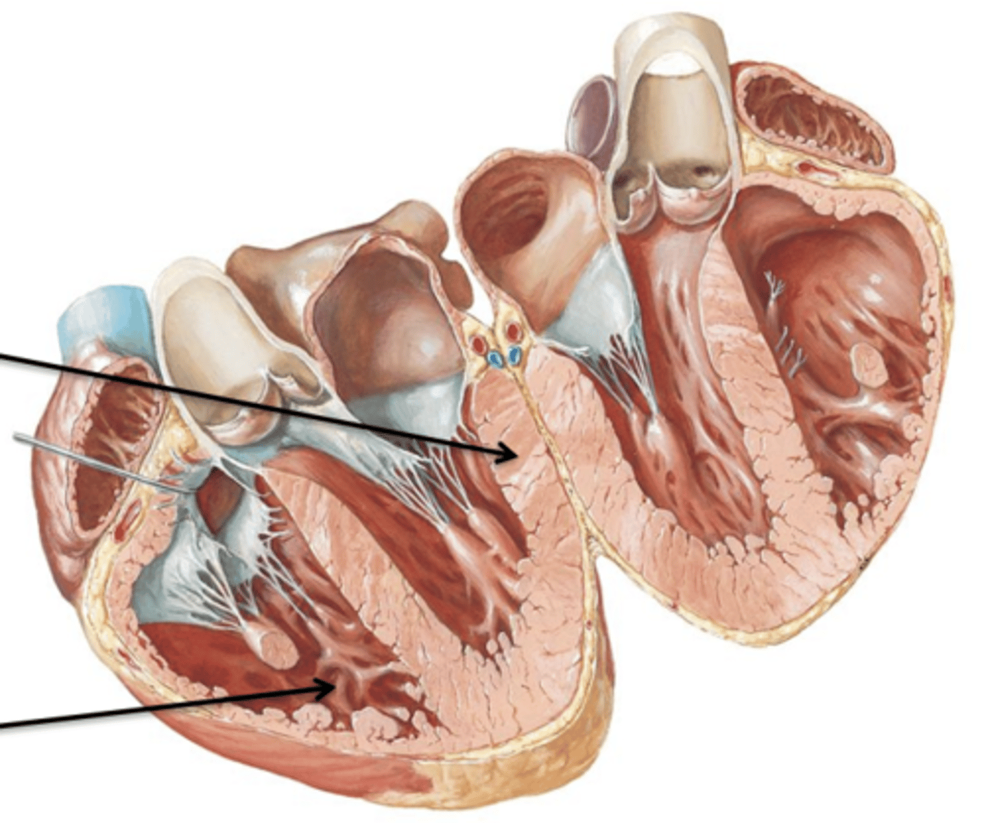 <p>Epithelial tissue lining the internal chambers of the heart.</p>