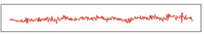 <p>Seen during alert wakefulness, desynchronization of EEG recordings</p>