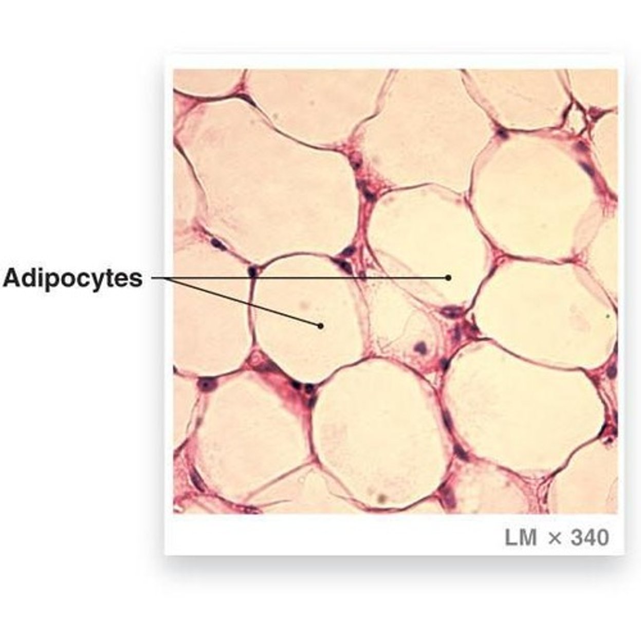 <p>Composed of specialized cells called adipocytes that have a large fat vacuole.</p>