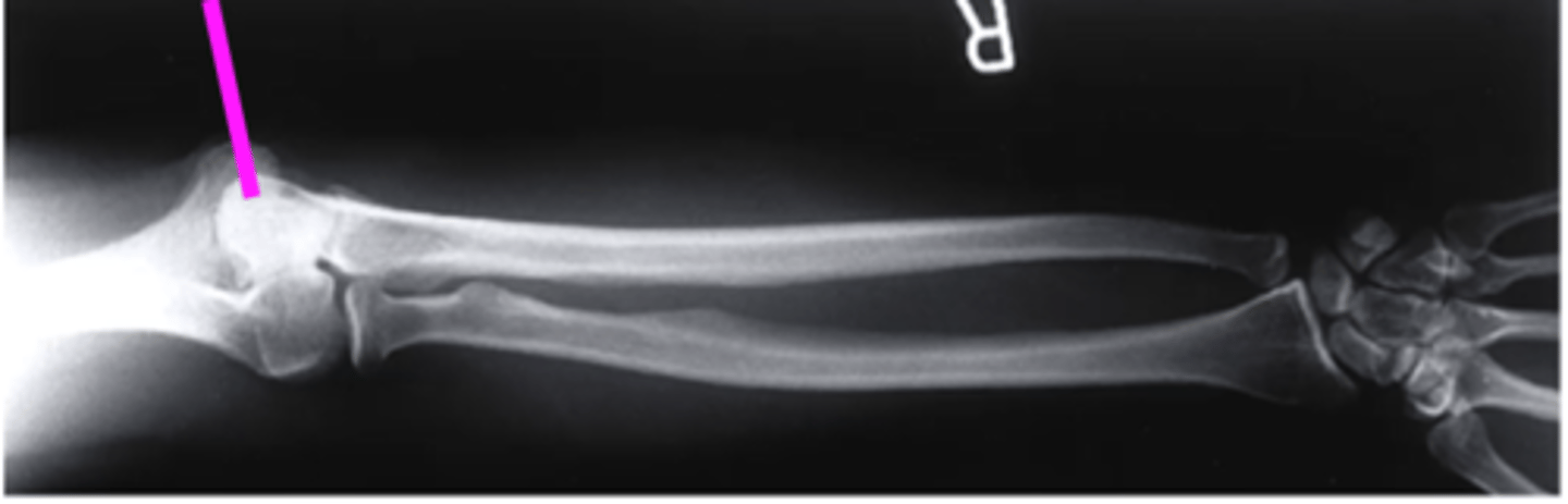 <p>what does this pink line point to?</p>