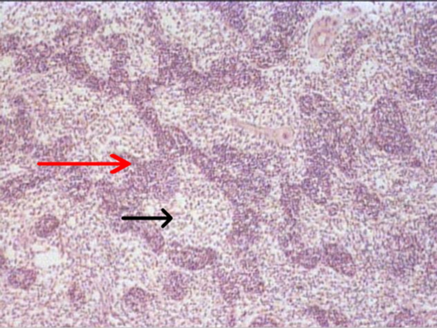 <p>red arrow</p><p>medullary cords</p>